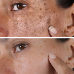 ضد آفتاب ضد لک سلرانیکو SPF 50