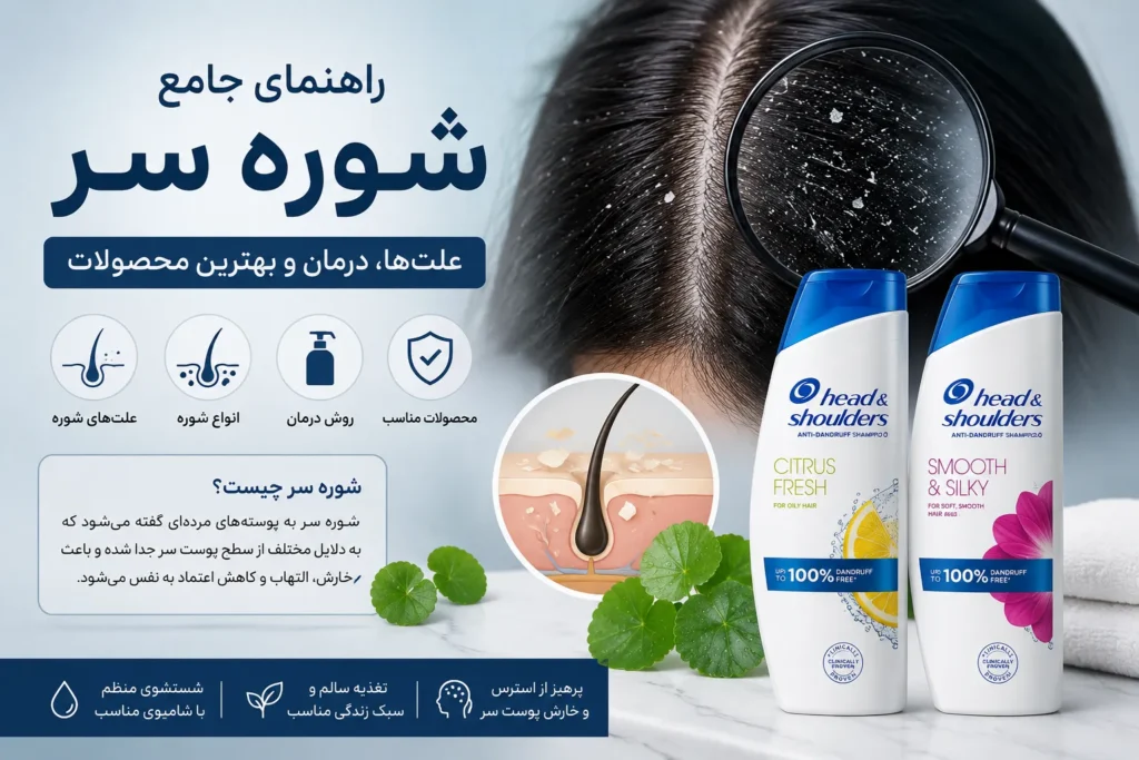 شوره سر, علت شوره سر, درمان شوره سر, محصولات ضد شوره, شامپوی مناسب شوره
