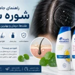 شوره سر, علت شوره سر, درمان شوره سر, محصولات ضد شوره, شامپوی مناسب شوره