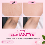 اسپری لایه بردار و روشن کننده Dr.Melaxin - تصویر 3